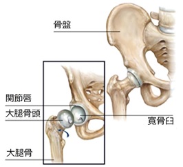 人工膝関節置換術の看護術直後の観察項目、合併症予防、生活指導などナース専科