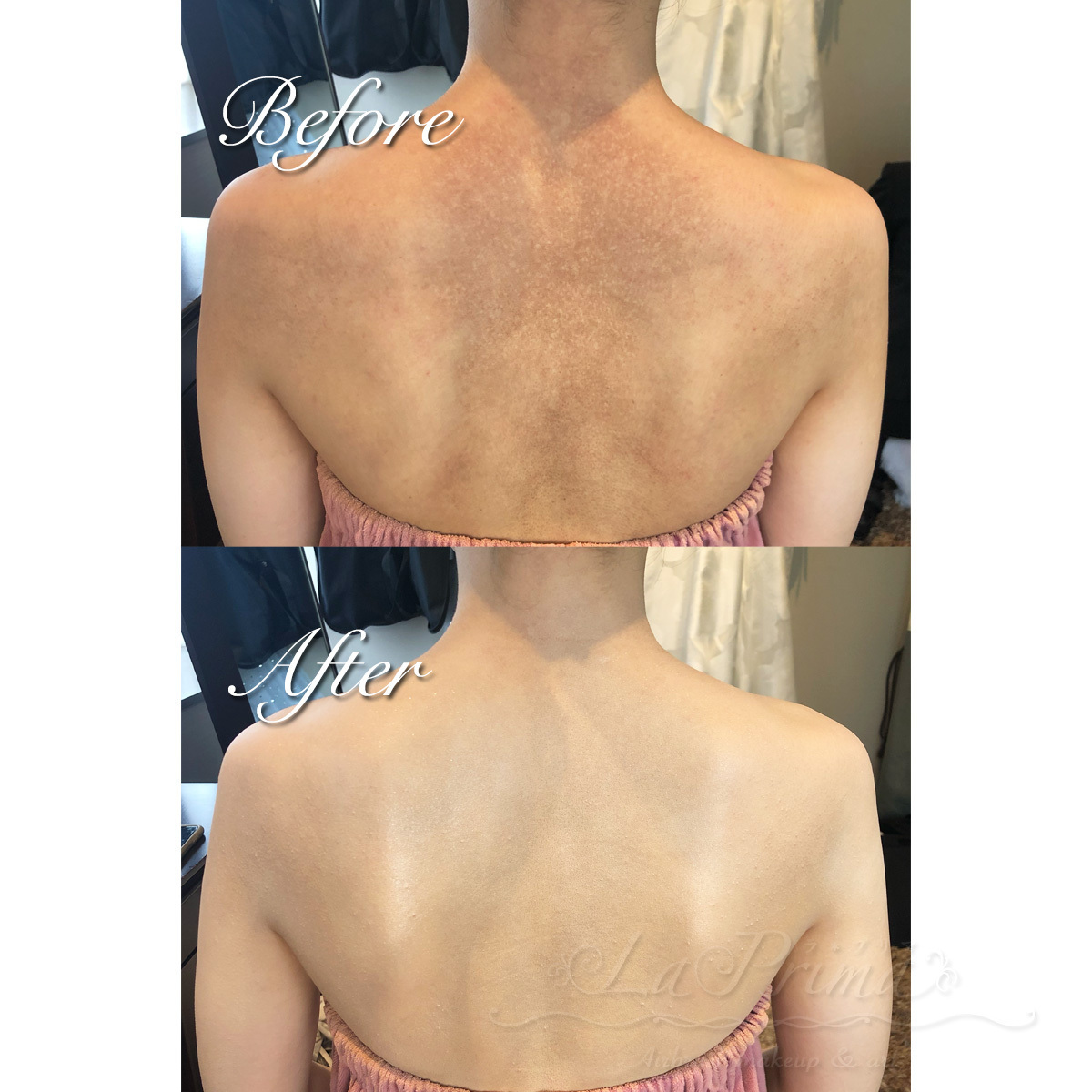 腰のかゆみ 症例1_12川崎市多摩区のアトピー専門整体「英気治療院」