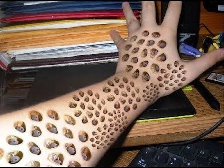 集合体恐怖症とは 小さい穴やブツブツが怖いトライポフォビアメンタルヘルスAll About