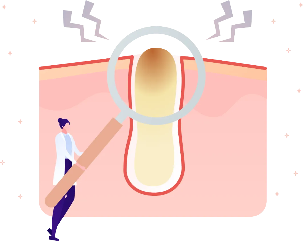 ニキビではないあごのブツブツやザラザラの原因は角栓？白い角栓ケア・対策を解説 - あしたの美肌