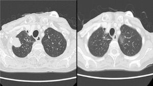 ライザップは｢糖質制限を広める会｣ではない RIZAPグループ社長が語る｢理想の健康食品｣食品東洋経済オンライン