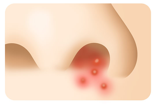 目で見る鼻副鼻腔の病気