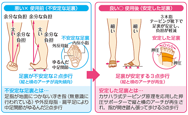 ふくらはぎに肉割れが起こる4つの原因と対策・ケア方法を紹介！ - グラマラスパッツシリーズ公式サイトYB-LAB