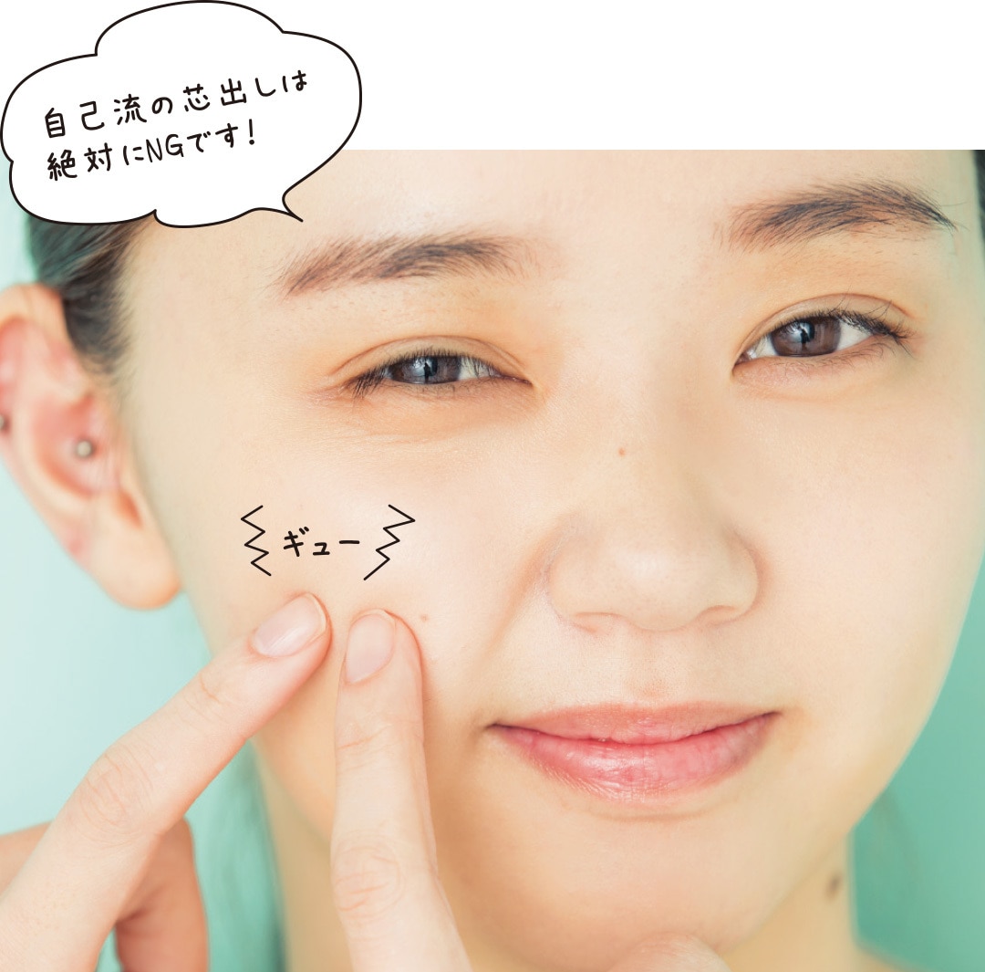 ニキビができたら、芯出しはするべきか否か？⑦ボンバー副社長の控えめに言いたい放題♡