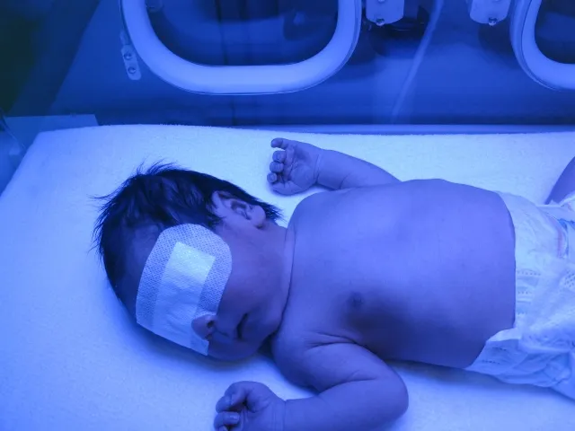 母乳性黄疸、おっぱいやめないで - HISAKOホーム