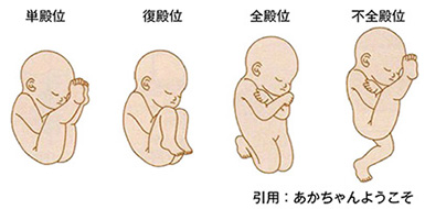 妊娠・出産の骨盤ケアについて - 埼玉県さいたま市浦和区 産婦人科の加藤クリニック埼玉県さいたま市浦和区 産婦人科の加藤クリニック