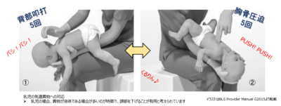 気道異物の除去北海道深川市