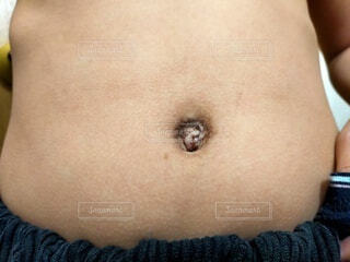 美しい理想のおへそを手に入れる！「べそ」の悩みを解決 医師監修 大西皮フ科形成外科医院