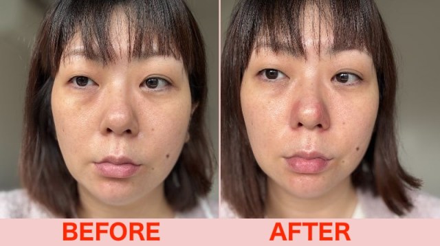 ルクセアフォーネス 鼻専用美顔器の効果と使い方