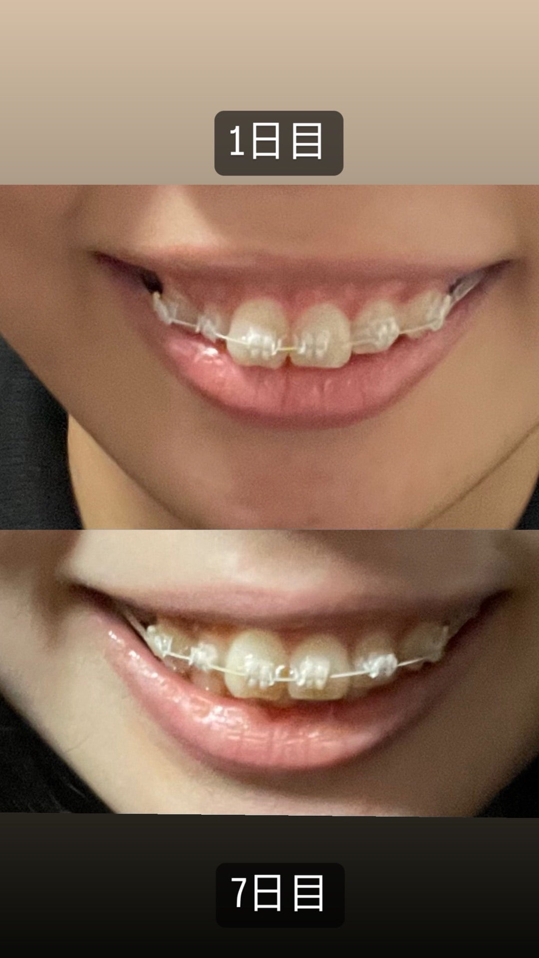 ちゃんまり@ナカモトフウフ on X: 