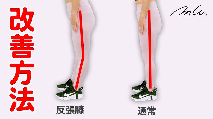 変形性膝関節症とは？理学療法士が対処法を解説＜公式＞脳梗塞リハビリBOT静岡