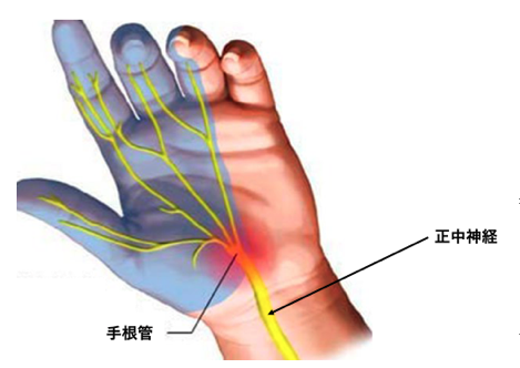 手足のしびれは糖尿病！？原因や検査方法について医師が解説