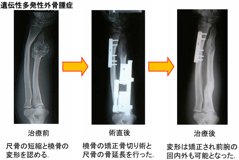 ゴールデンカムイの｢カムイ｣はいったい何なのか - ライブドアニュース
