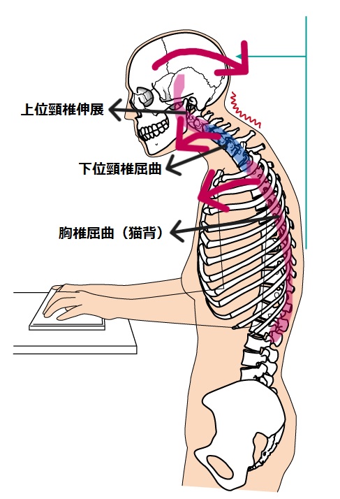 楽天市場 肩甲骨 を引き寄せる 猫背矯正ベルト 猫背ケアベルト メンズ レディース 姿勢補正 女性 猫背補正 男性 姿勢矯正 サポーター メッシュソフト素材 巻き肩 改善 補正ベルト 猫背 ねこ背 背筋ベルト 肩サポーター フリーサイズ クリックポスト : インクリースイン