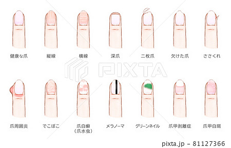 爪・指・つま先の病気足と歩行の診療所