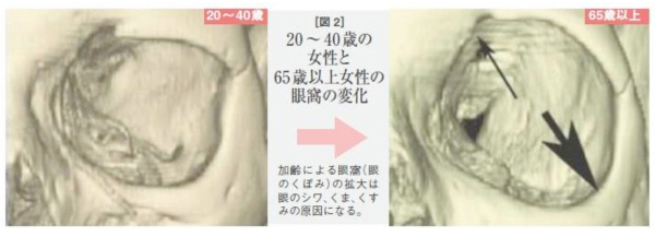 あなたの鼻は大丈夫⁉ 若いころに比べてどんどん鼻が大きくなる「鼻老化」の原因は ？ – STORYストーリィオフィシャルサイト