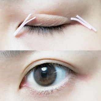 比較検証 絶対二重にならない一重にもおすすめなアイプチ® はあの定番アイテムだった 一重・奥二重のお悩み解決！ 美容メディアVOCE ヴォーチェ