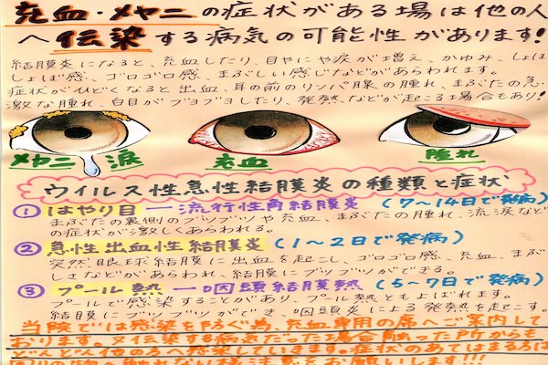 目やにでわかる目やにの原因 細菌性結膜炎？アレルギー性結膜炎？ウイルス性結膜炎？: ある奈良県の眼科医が目について書いたブログ