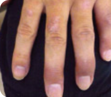 乾癬性関節炎こばとも皮膚科栄駅 名古屋市栄区 徒歩2分