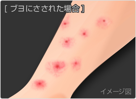 日本臨床皮膚科医会-ひふの病気