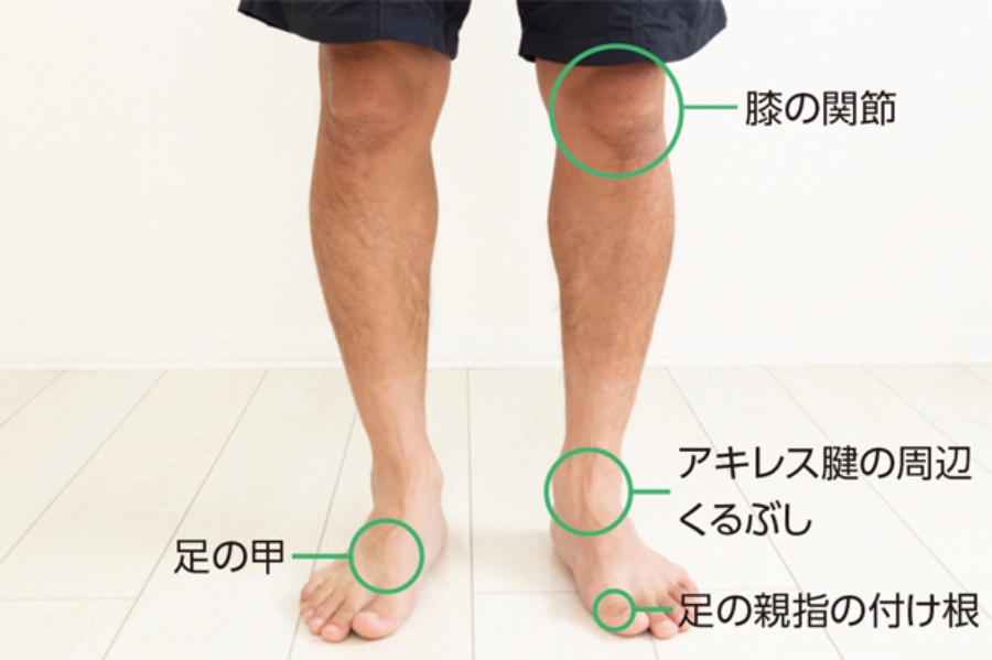５０代の痛風の男性が左股関節痛で来院病的疾患スタッフブログ鎌倉市のスポーツ外傷・怪我治療なら大船接骨院