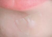 25歳ですが、昔からほうれい線が出来やすく、笑ったあとこのようになっ- Yahoo!知恵袋