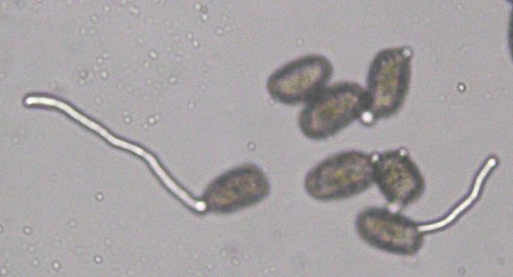 走査型電子顕微鏡によるテッポウユリの花粉 顕微鏡倍率 ×１０ 32258005492 の写真・イラスト素材アマナイメージズ