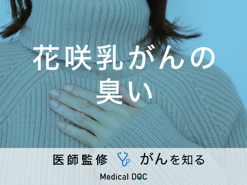 花咲乳がん」を発症すると「どんな臭い」がする？ 花咲乳がんは乳がんの種類ではなく、乳がんが進行して皮膚に潰瘍ができた状態です。花咲乳がんになると、潰瘍から強烈な悪臭がするといわれています。花咲乳がんで不快な臭いがする原因や治療法・悪臭のケア方法を解説し