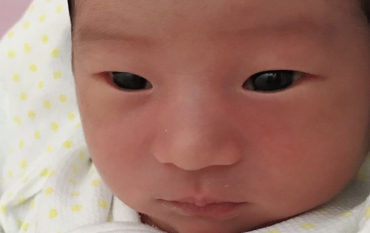 赤ちゃん一重から二重 2歳TikTok