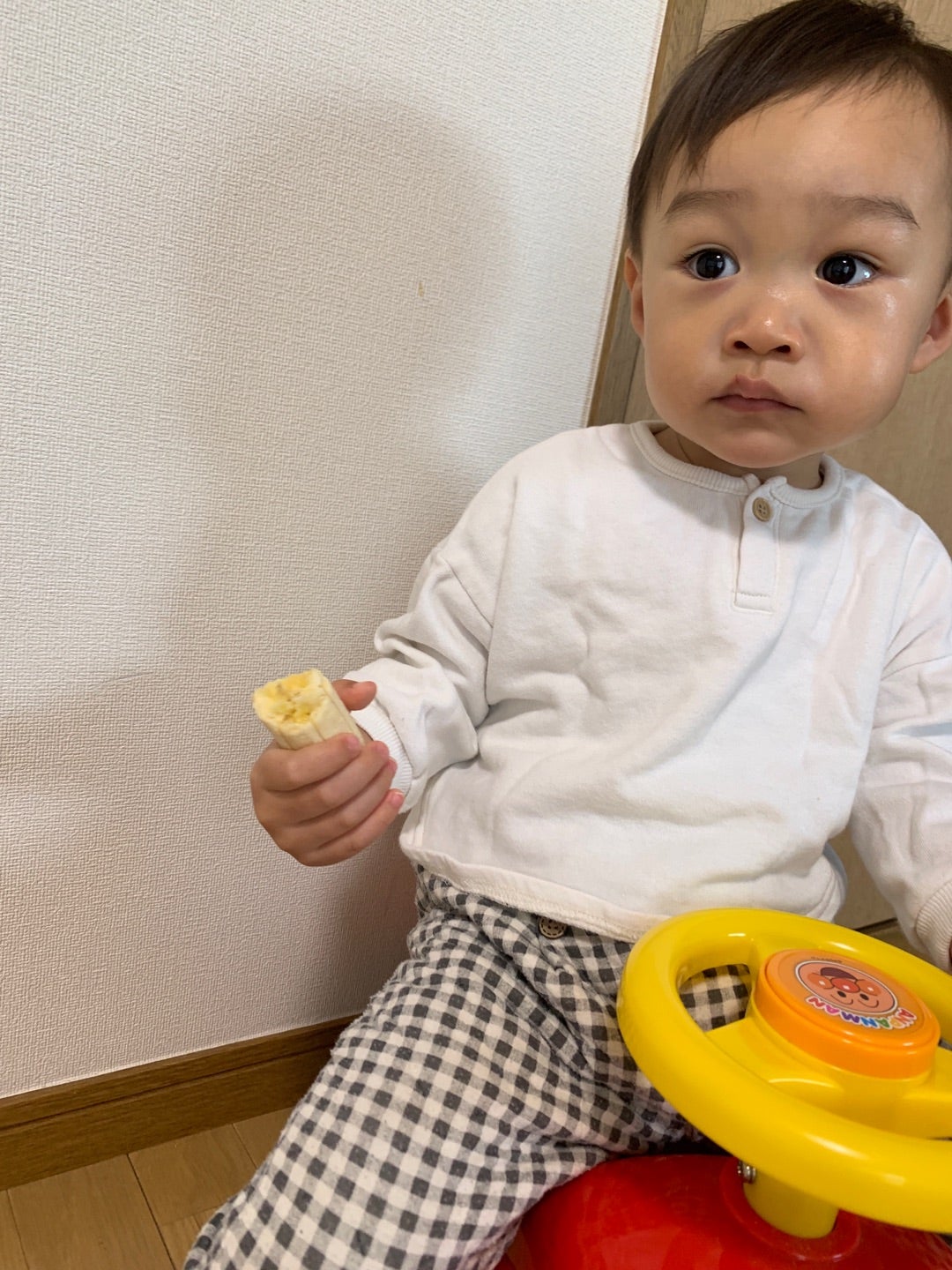 生まれつき目の下のクマがひどい・消えない 骨格などの原因 10代・20代の対策と治療法横浜市鶴見の形成・美容外科 エムズクリニック