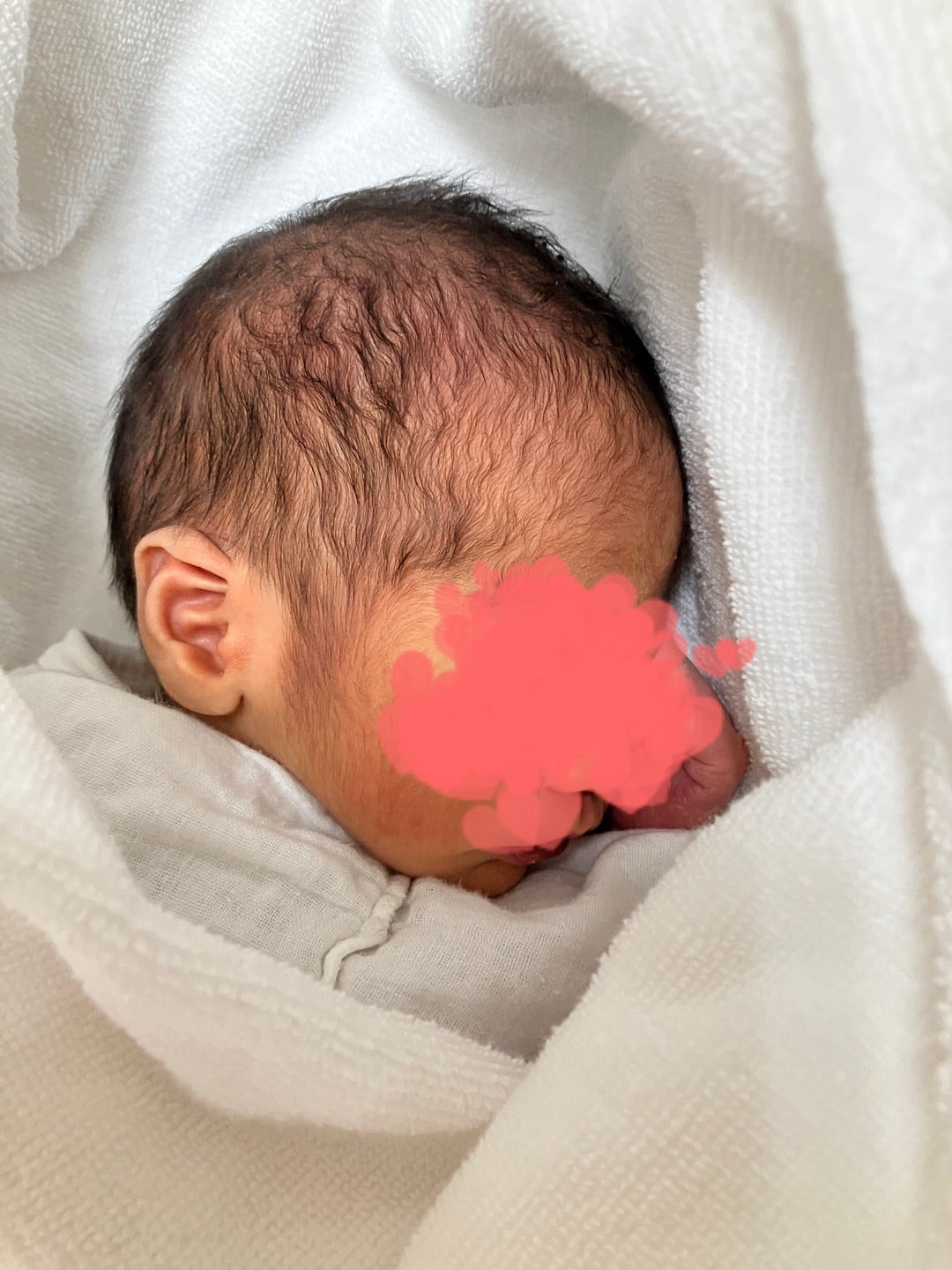 斜頭症・絶壁頭 短頭症 の症例写真 1〜8回目② 大阪の赤ちゃん整体 整体サロンINUI整体サロンINUI