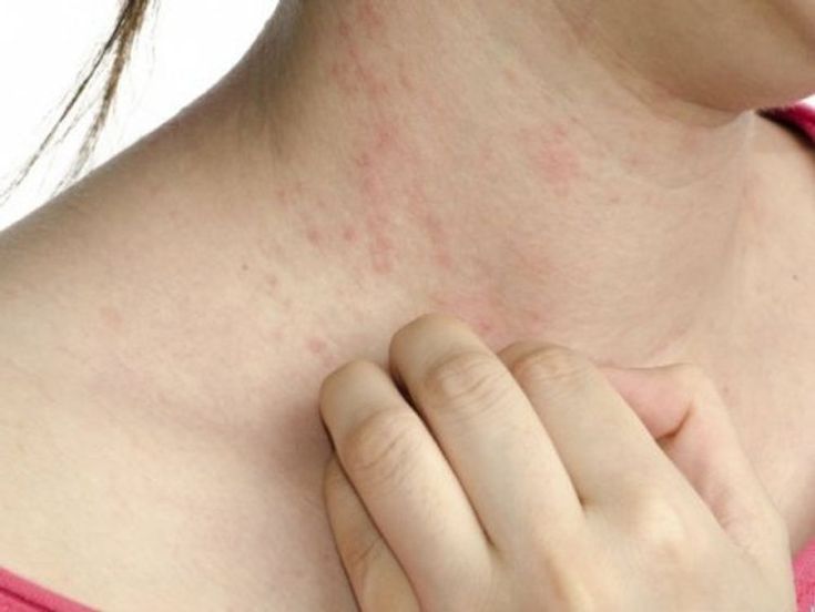 糖尿病と皮膚の病気江草玄士クリニック