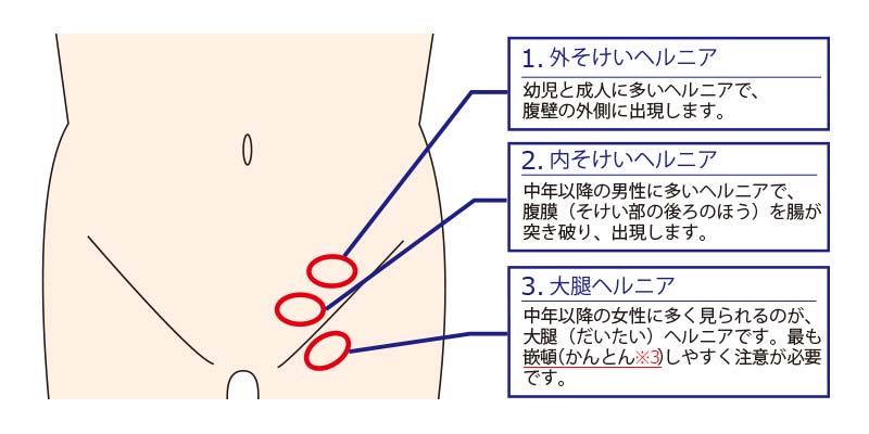 メジカルビュー社産婦人科・周産期医学実践的 妊娠初期胎児超音波検査 Web動画付