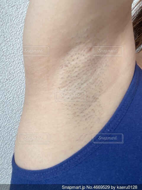 脇脱毛は当たり前☆山口県宇部市の脱毛サロン・黄土スチームケアサロンRevept-レヴィート