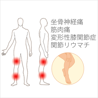 足の痛み 足の付け根の痛み・足がこわばる 千葉市中央区にある、みやこ