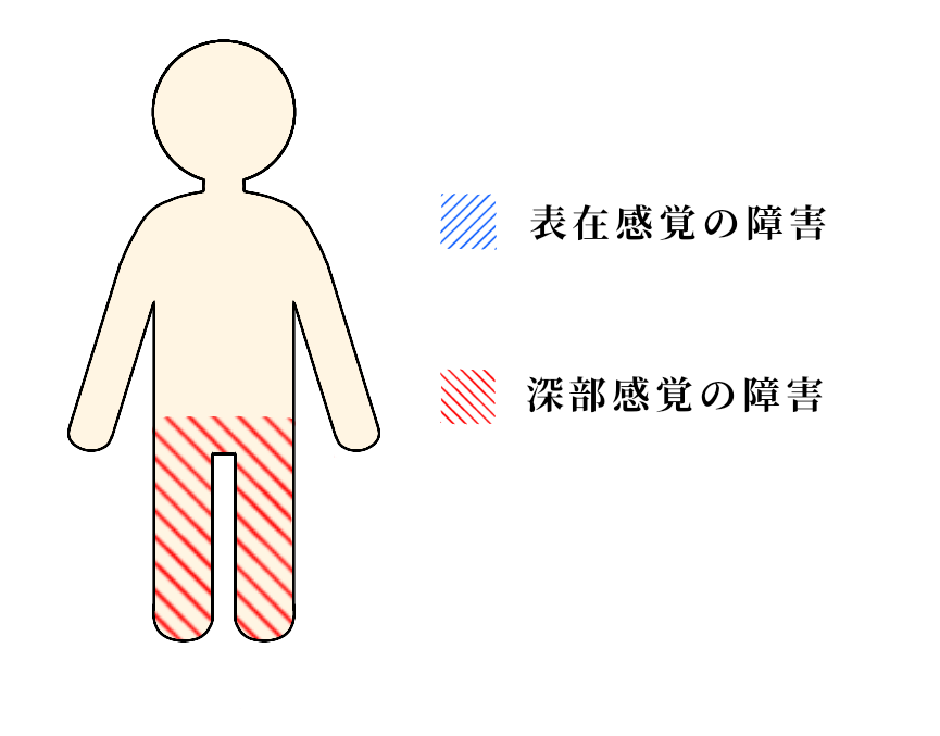 自律神経障害の看護原因、症状、アセスメントとケアナース専科