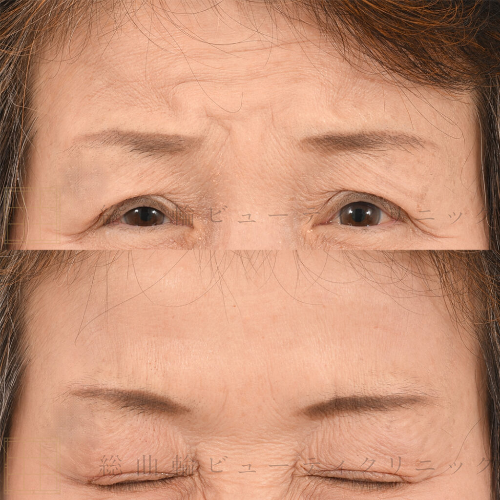 コラム 人相学「眉間が広いと ？眉間が狭いと美的センスが ？」青木智鑑定事務所＆手相スクール