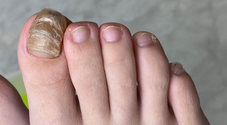 お客様によく質問されます⁡ この部分って大きいと健康なの？？ ⁡ 答えはNO ⁡ この爪半月と言う部分は 言ってみたら 爪の赤ちゃん部分✨ ⁡生まれたての爪なので 柔らかく、水分量も多いので 白く見える ⁡ 人によっても違うし 年齢によっても違う 指によっても違う