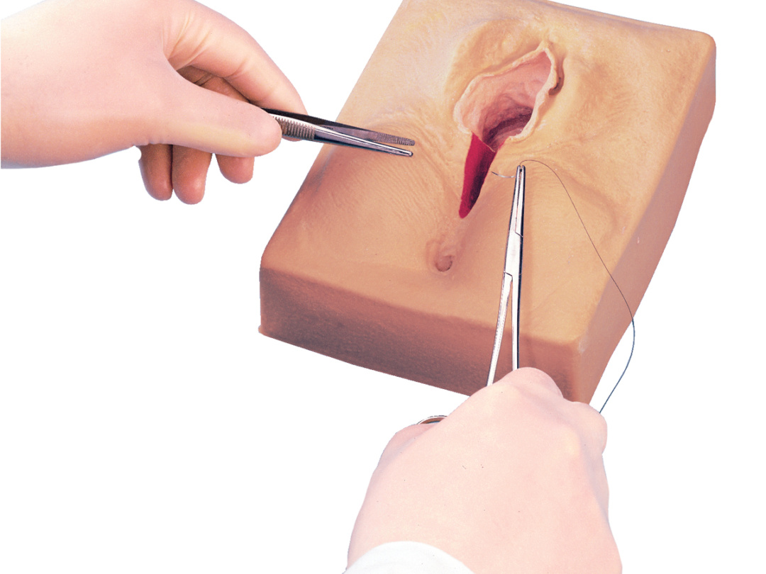 会陰切開、吸引・鉗子分娩 出産のときの大切な医療処置たまひよ