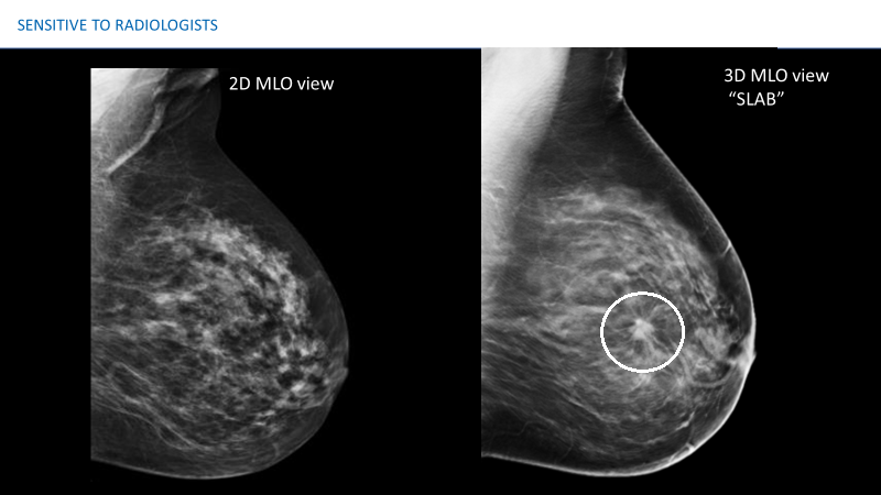 若年乳腺エコー 超音波 検診公益社団法人北海道勤労者医療協会 勤医協中央病院