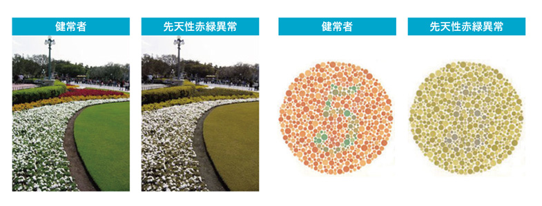 色覚異常について院長からのメッセージ診療内容ゆかわ眼科クリニックのホームページ