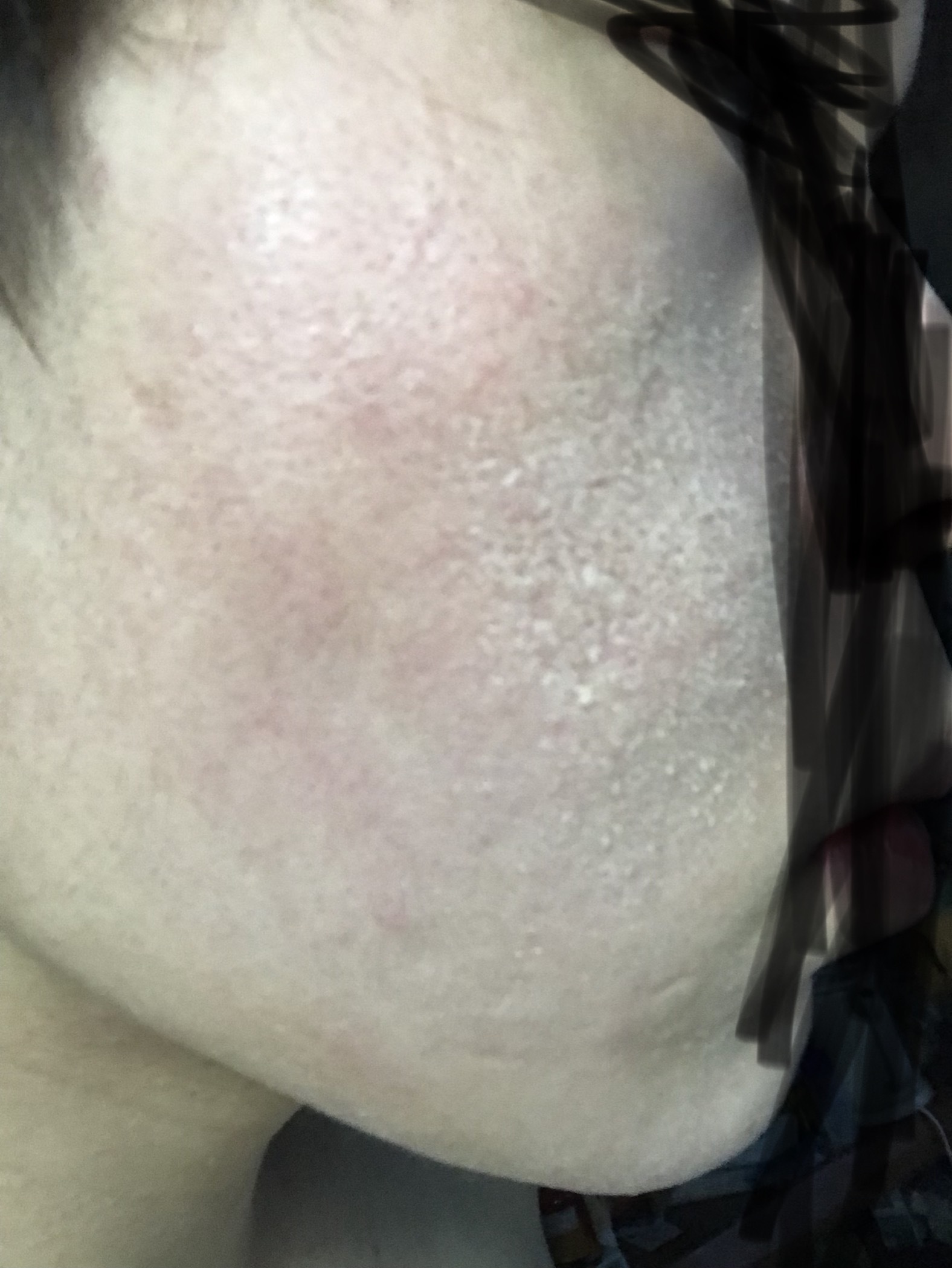 スキンケアの新常識: 肌断食のメリット