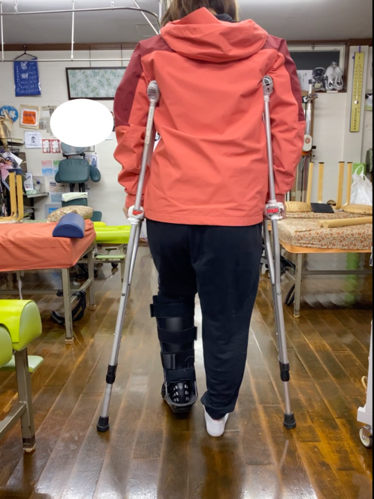 足を骨折して思い知ったことビフォーアフター社会 不便すぎ- イーアイデム「ジモコロ」