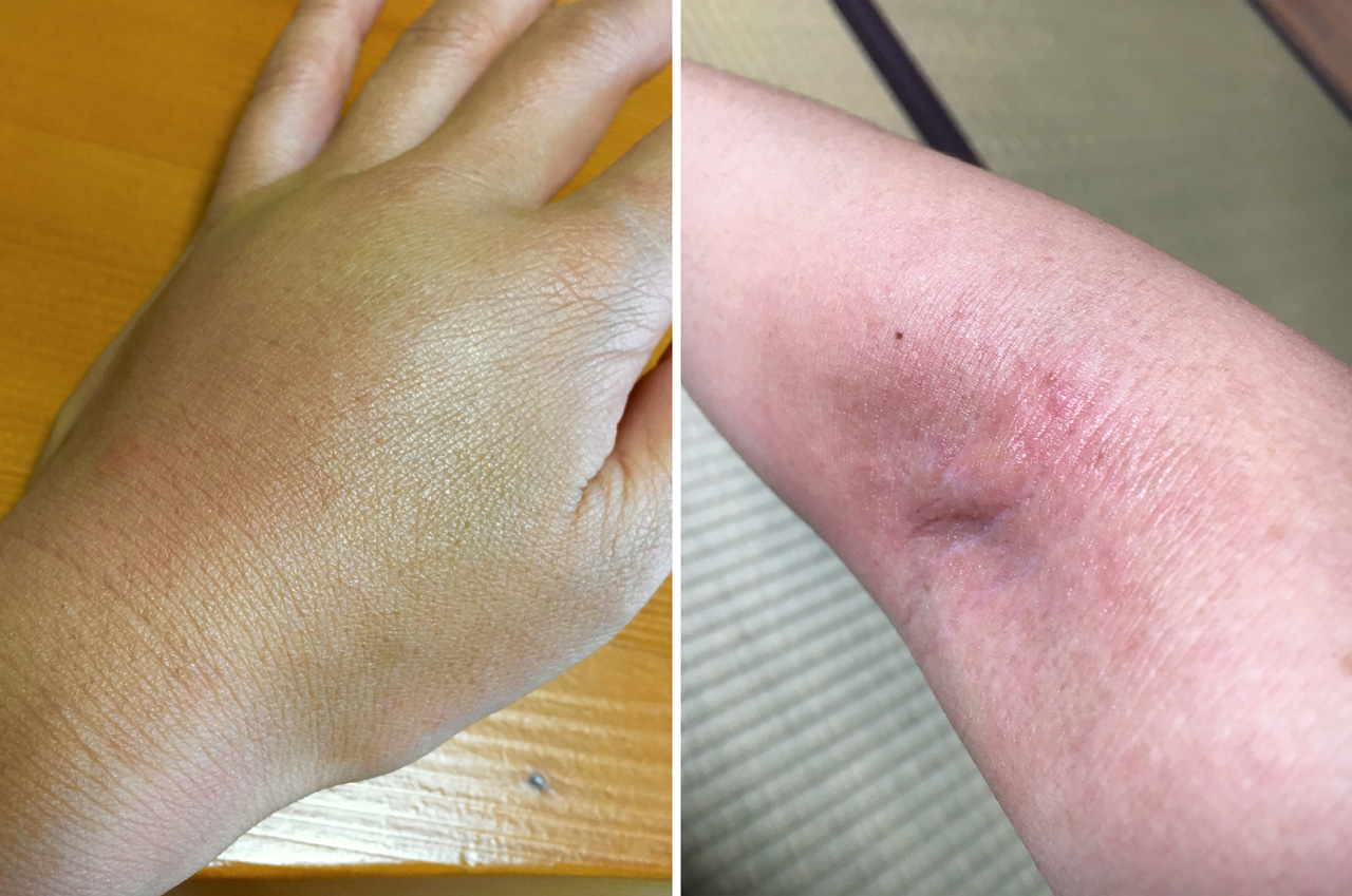 👇詳しく解説⚠️オキナワチビアシナガバチ, ちっちゃくても痛いよ〜😣, 沖縄の海岸では気をつけたほうがいい🐝,沖縄の海岸近くの茂みでよく出会うのが, この小さな小さなアシナガバチの仲間。, 国内最小のアシナガバチとも言われ, その名も「オキナワチビアシナガバチ 」, 海岸沿いのアダンやススキの葉の裏に, 数センチの小さな可愛らしい巣を作ります。,蜂自体も1−2cmととても小さい。,