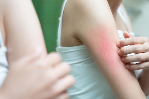 ステロイド外用薬「プレドニン眼軟膏 プレドニゾロン酢酸エステル 」ウィーククラス - 巣鴨千石皮ふ科