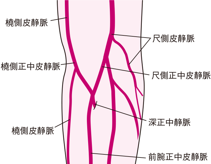 橈骨動脈-橈側皮静脈AVF 側端吻合イラスト - No: 23791893無料イラスト・フリー素材なら「イラストAC」
