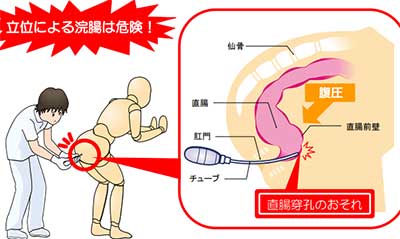 正しいアナルの洗い方とコツ】お尻の準備！綺麗に直腸洗浄をする方法 | 【きもイク】気持ちよくイクカラダ