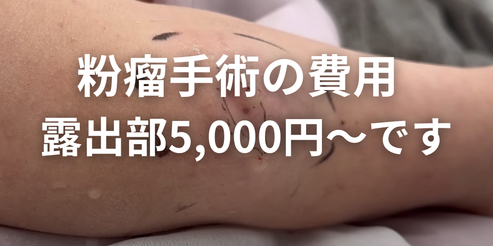 粉瘤除去 – デイクリニック天神