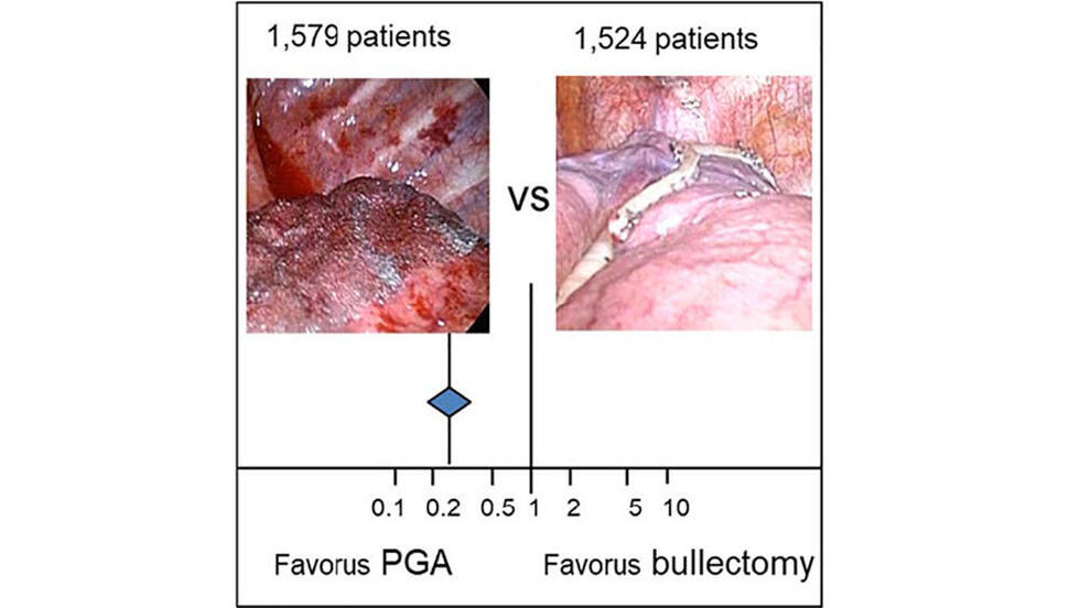 肺がん 全ページ： 国立がん研究センター がん情報サービス 一般の方へ