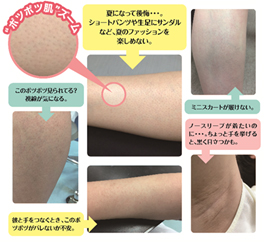 カミソリ負けを治すのは市販薬でいい? 皮膚科ではどんな治療をする?Abao-Aqu アバオ・アクー